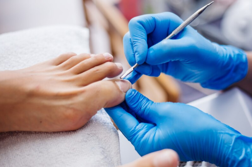 Removing Foot Calluses