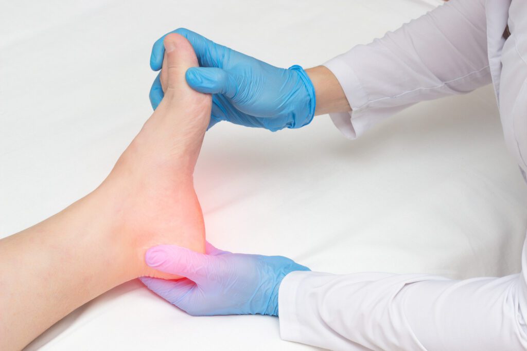 Doctor examines the sore heel of a woman who has a heel spur, orthopedist